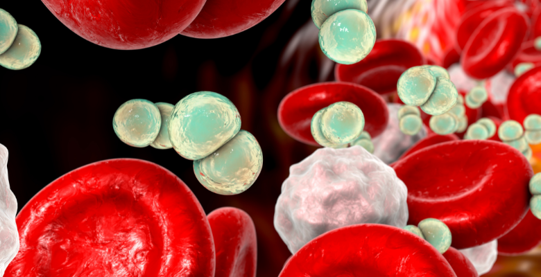 sepsis